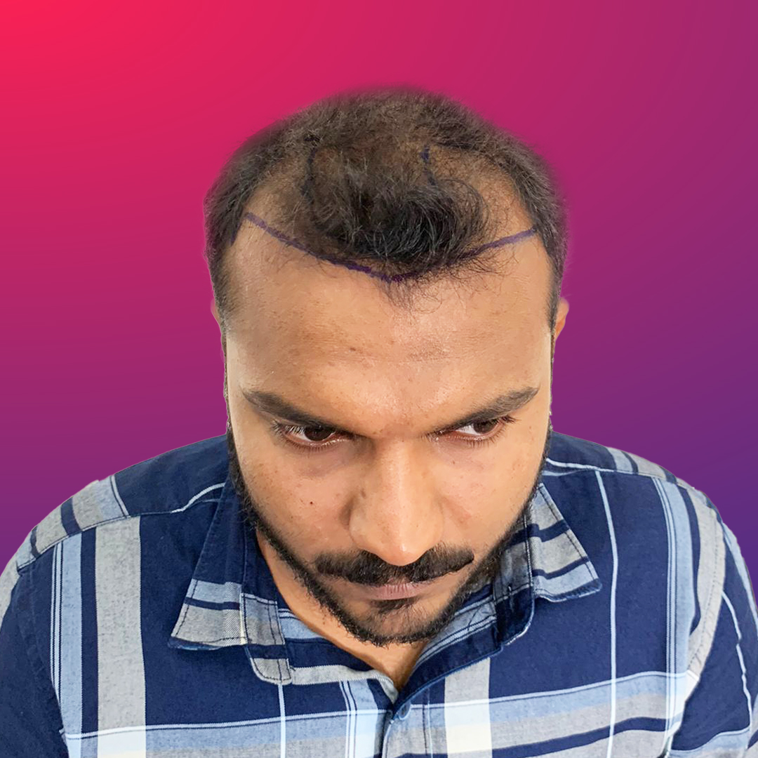 Cutis International result